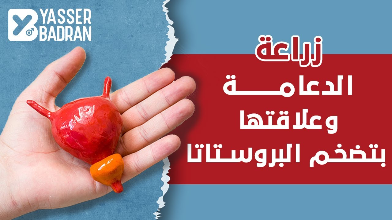 زراعة الدعامة وعلاقتها بتضخم البروستاتا