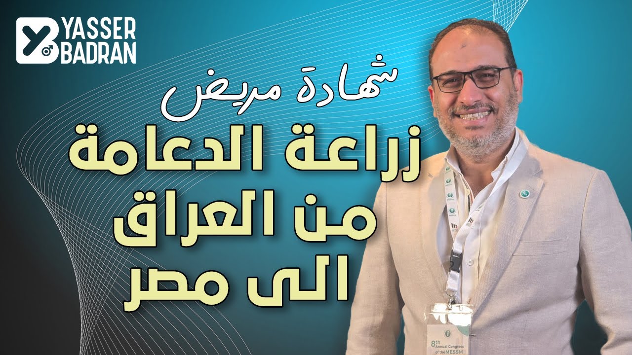 تجربتي من العراق إلى مصر: زراعة الدعامة وتغيير حياتي